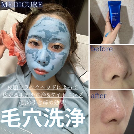 ゼロ毛穴クレイパック/MEDICUBE/洗い流すパック・マスクを使ったクチコミ(1枚目)