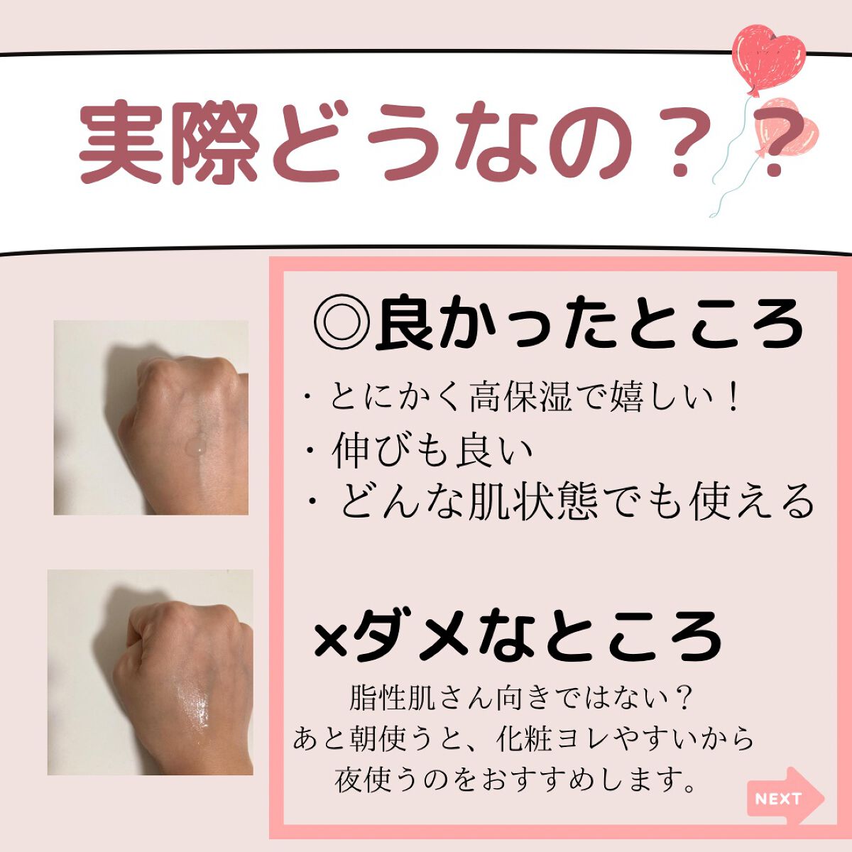 モイスチュア ローション/カルテHD/化粧水を使ったクチコミ(5枚目)