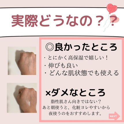 モイスチュア ローション/カルテHD/化粧水を使ったクチコミ(5枚目)