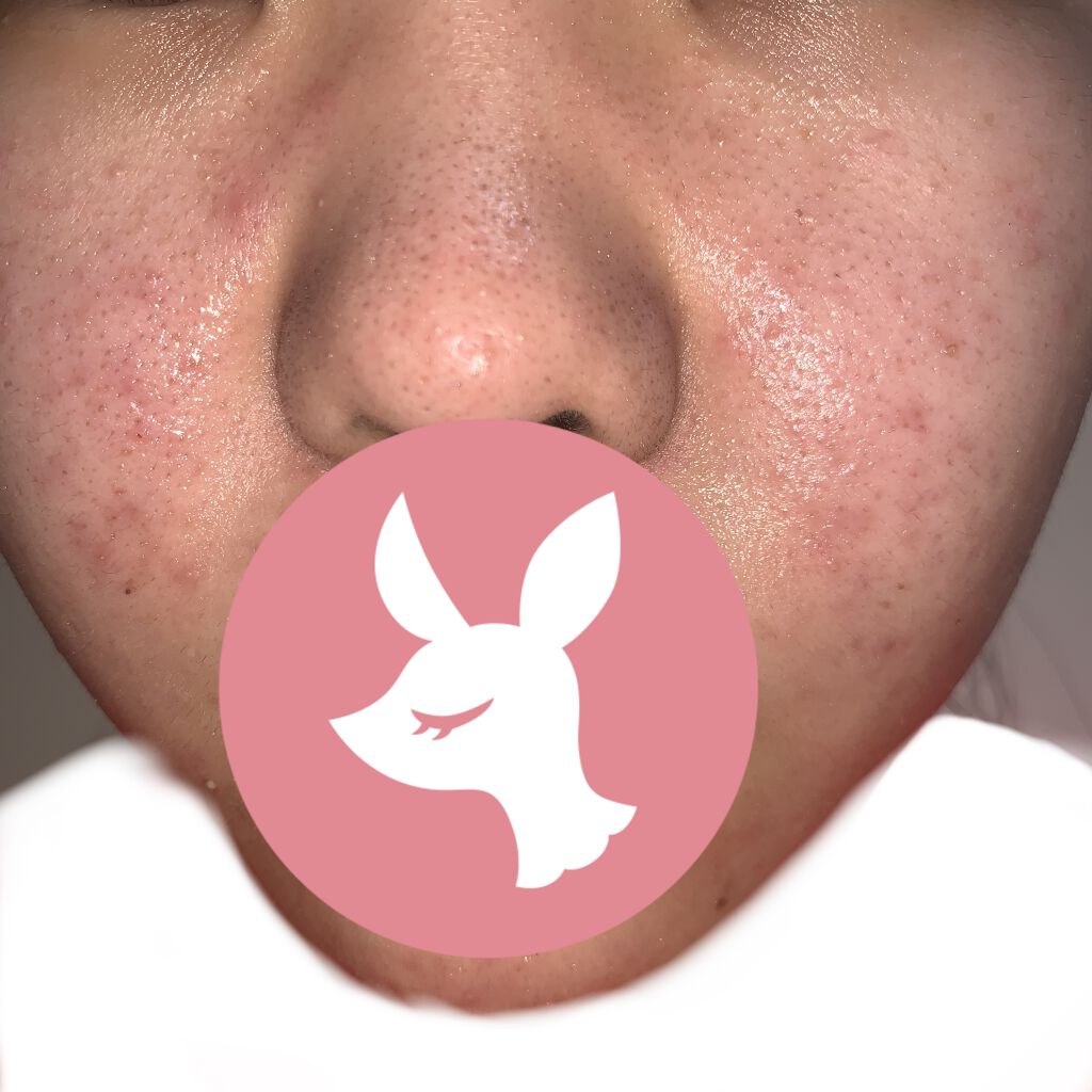 薬用しみ対策 美白化粧水/メラノCC/化粧水を使ったクチコミ（3枚目）