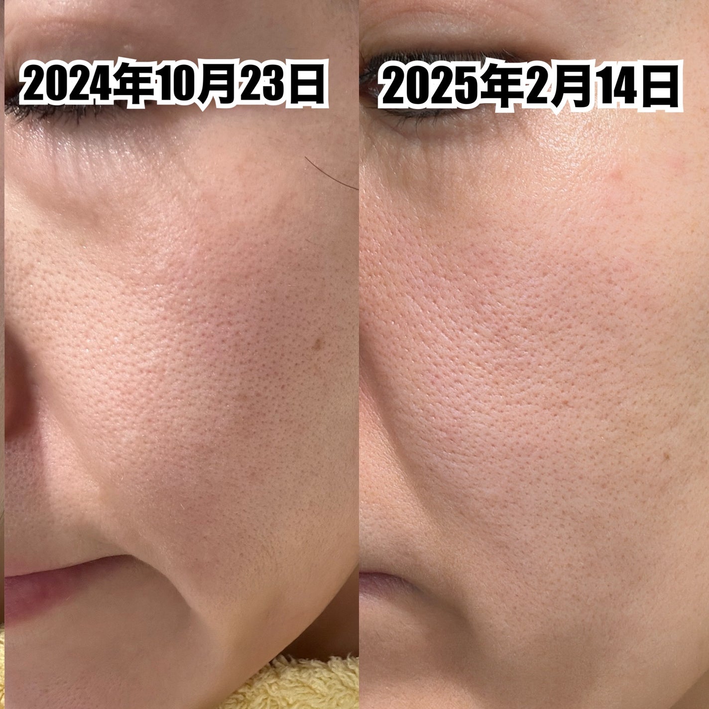 カプチュール トータル レチショット/Dior/美容液を使ったクチコミ(3枚目)