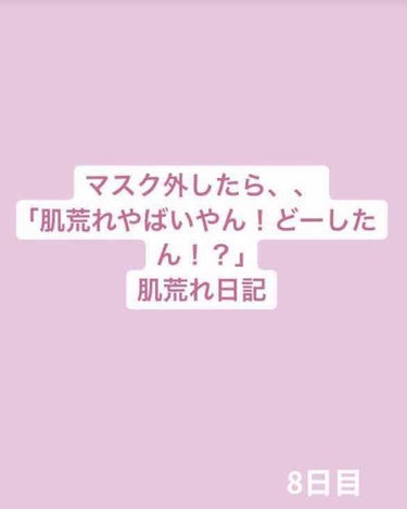 ふりすく on LIPS 「眉上？と左目の下、鼻の付け根あたりのニキビが少し大人しくなった..」（1枚目）