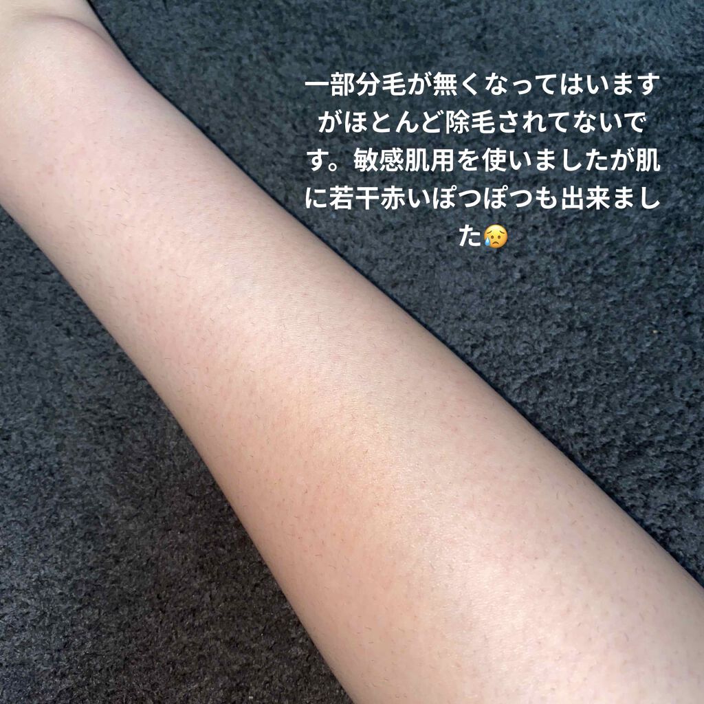 除毛クリームキット敏感肌用/エピラット/除毛クリームを使ったクチコミ(3枚目)
