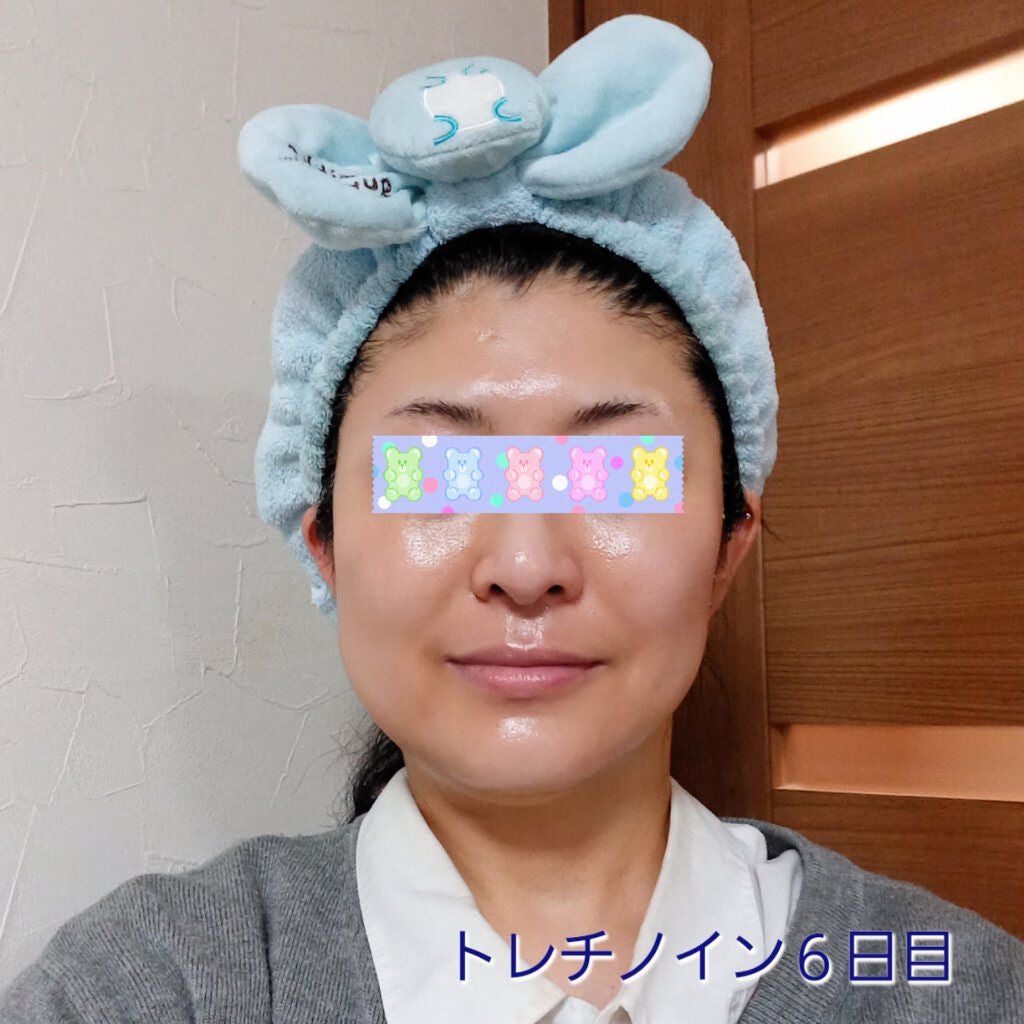 極潤α リフトクリーム/肌ラボ/フェイスクリームを使ったクチコミ(1枚目)