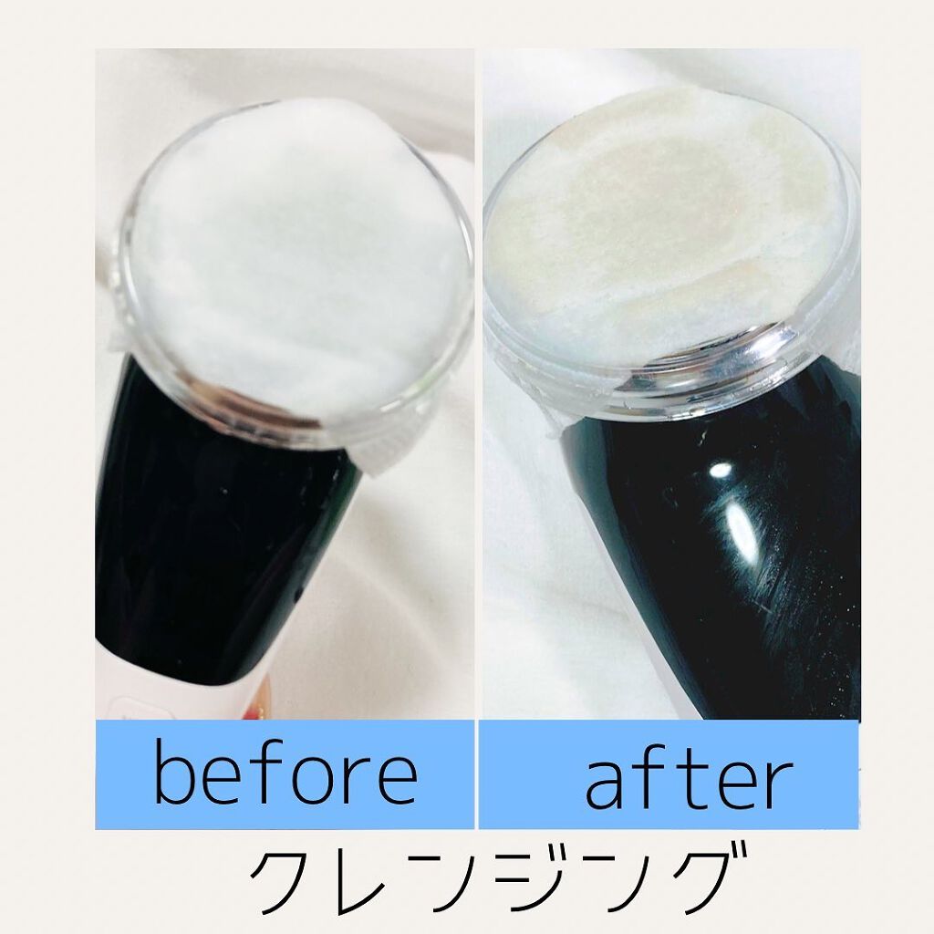 多機能温冷美顔器/ANLAN/美顔器・マッサージを使ったクチコミ(7枚目)