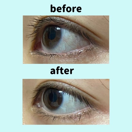 スマイルホワイティエ(医薬品)/ライオン/その他を使ったクチコミ(3枚目)