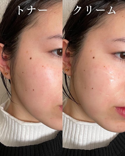 レッドブレミッシュ クリアスージングトナー/Dr.G/化粧水を使ったクチコミ(5枚目)