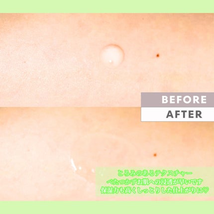 Abo on LIPS 「やっほーAboです🤍✨💛Mastina💛❤ホワイトマスティック..」(4枚目)