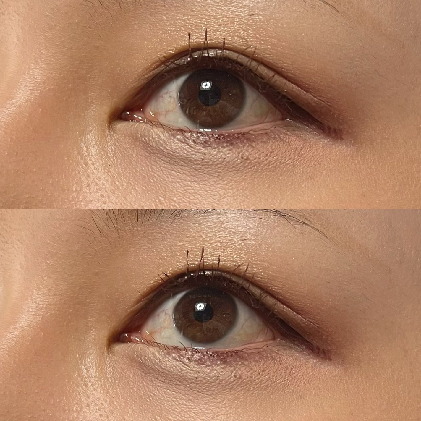 オリシキ アイリッドスキンフィルム /D-UP/二重まぶた用アイテムを使ったクチコミ(5枚目)