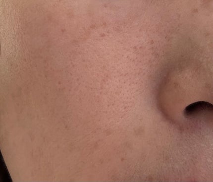 目ざまシート N/サボリーノ/シートマスク・パックを使ったクチコミ(4枚目)