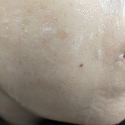 ディズニー100周年記念フェイスマスク ハニールミナスロイヤルプロポ シートマスクプラス プロポリス/JMsolution-japan edition-/シートマスク・パックを使ったクチコミ(4枚目)