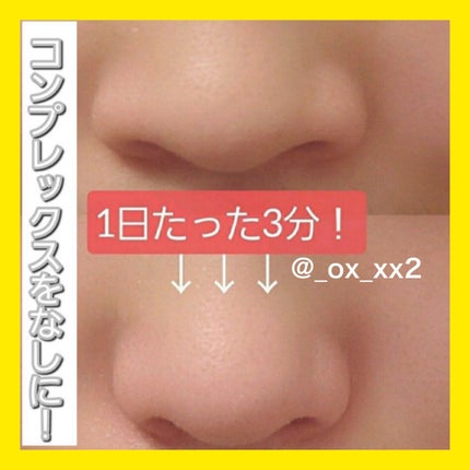 ハトムギ化粧水(ナチュリエ スキンコンディショナー R )/ナチュリエ/化粧水を使ったクチコミ(1枚目)