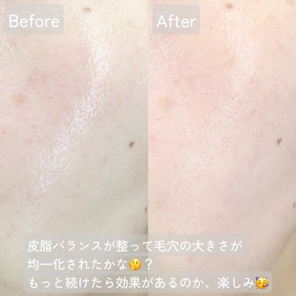 リードルショット100/VT/美容液を使ったクチコミ(6枚目)