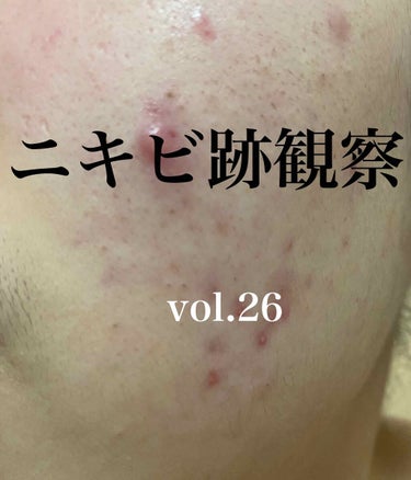 敏感肌用薬用美白美容液/無印良品/美容液を使ったクチコミ（1枚目）