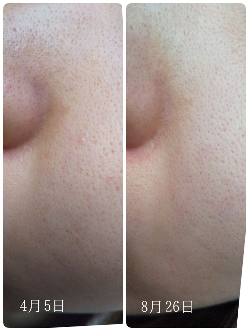 DHC マルチビタミン/DHC/美容サプリメントを使ったクチコミ（2枚目）