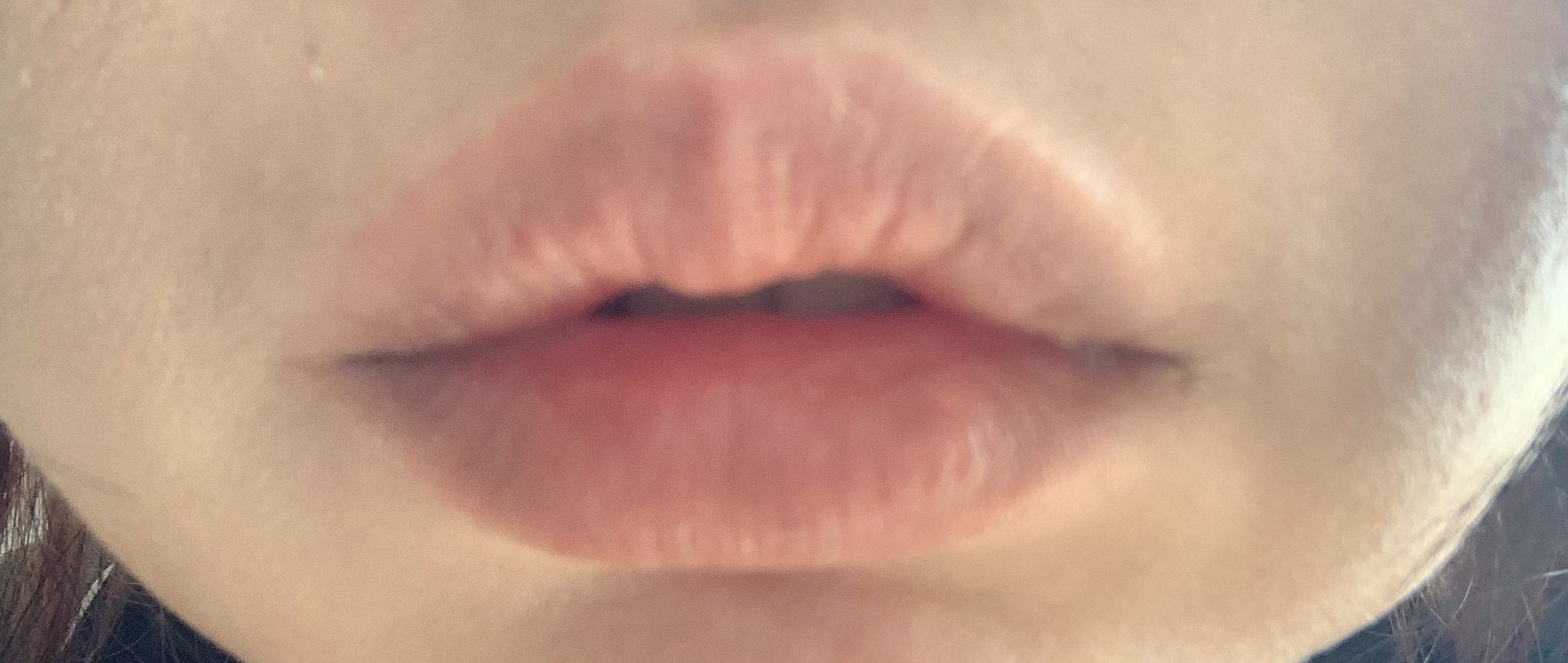 リンクルリップエッセンス プランパー/ザ・レチノタイム/リッププランパーを使ったクチコミ（2枚目）