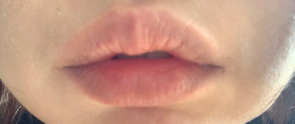 リンクルリップエッセンス プランパー/ザ・レチノタイム/リッププランパーを使ったクチコミ(2枚目)