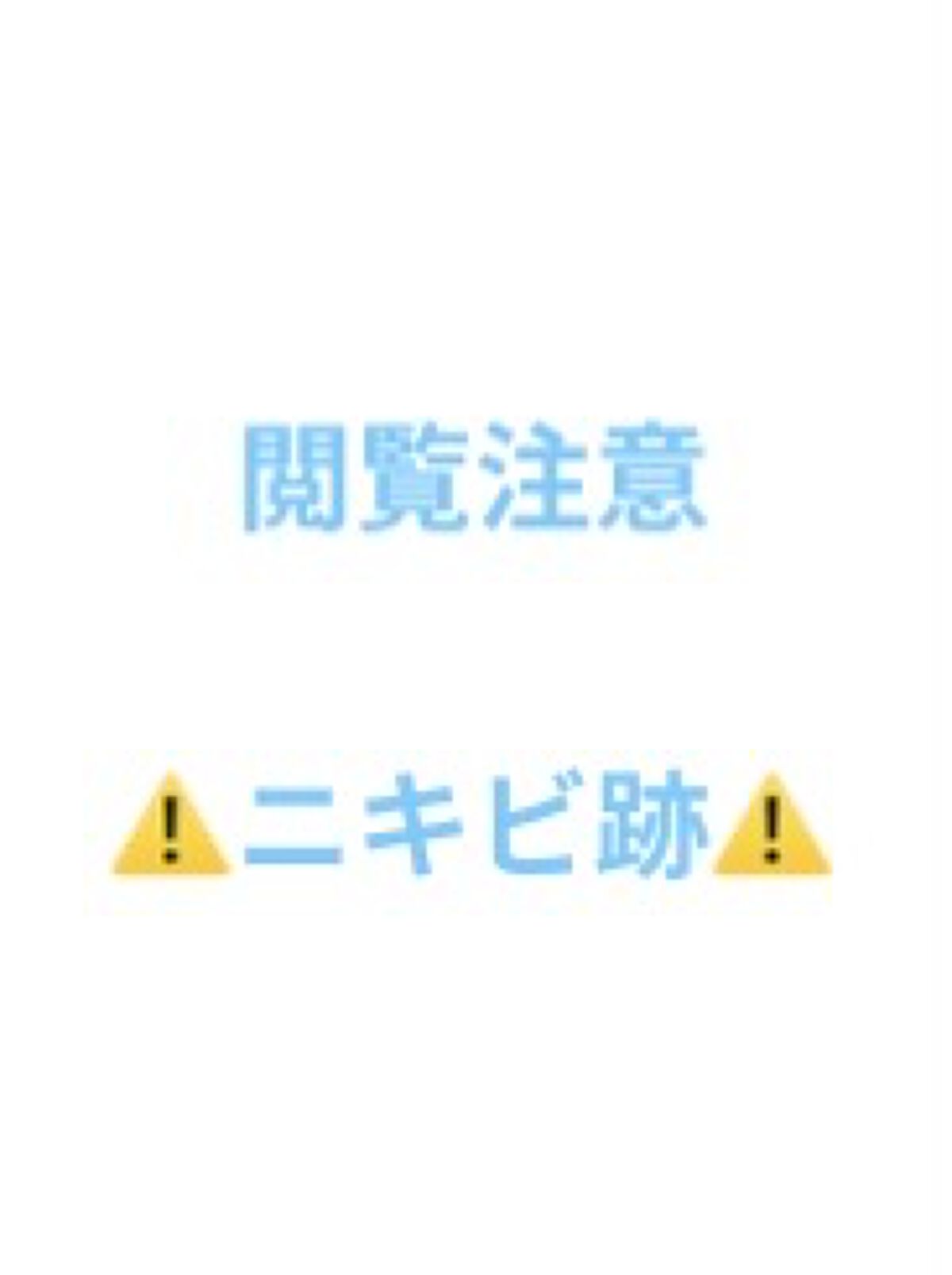 AHA 30% + BHA 2% Peeling Solution/The Ordinary/ピーリングを使ったクチコミ（1枚目）