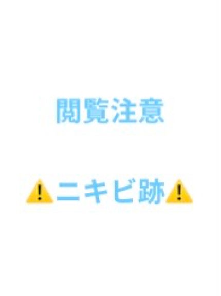 AHA 30% + BHA 2% Peeling Solution/The Ordinary/ピーリングを使ったクチコミ(1枚目)