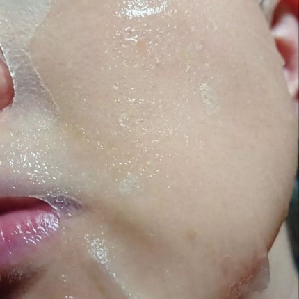 センテラ ウォーターゲルシートアンプルマスク/SKIN1004/シートマスク・パックを使ったクチコミ(3枚目)