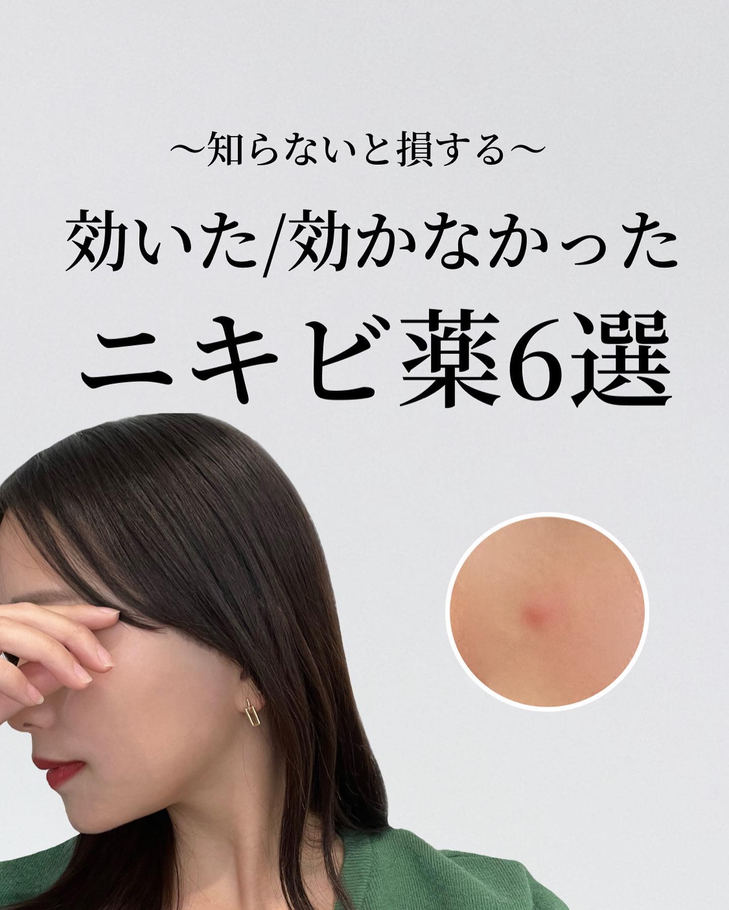 びふナイト/小林薬品/フェイスクリームを使ったクチコミ（1枚目）