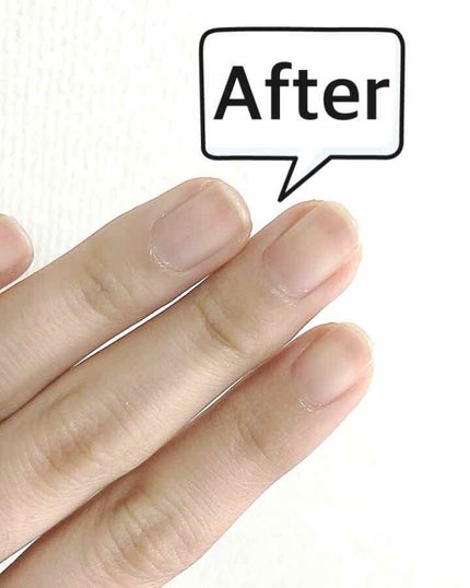 エテュセ クイックケアコート/ettusais/ネイルオイル・トリートメントを使ったクチコミ(3枚目)