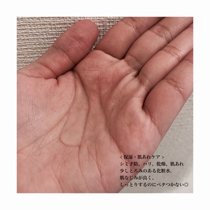 バランスケア ローション RM/アクアレーベル/化粧水を使ったクチコミ(2枚目)