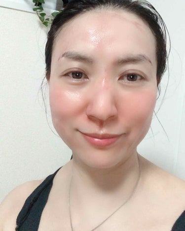 AHA 30% + BHA 2% Peeling Solution/The Ordinary/ピーリングを使ったクチコミ（2枚目）