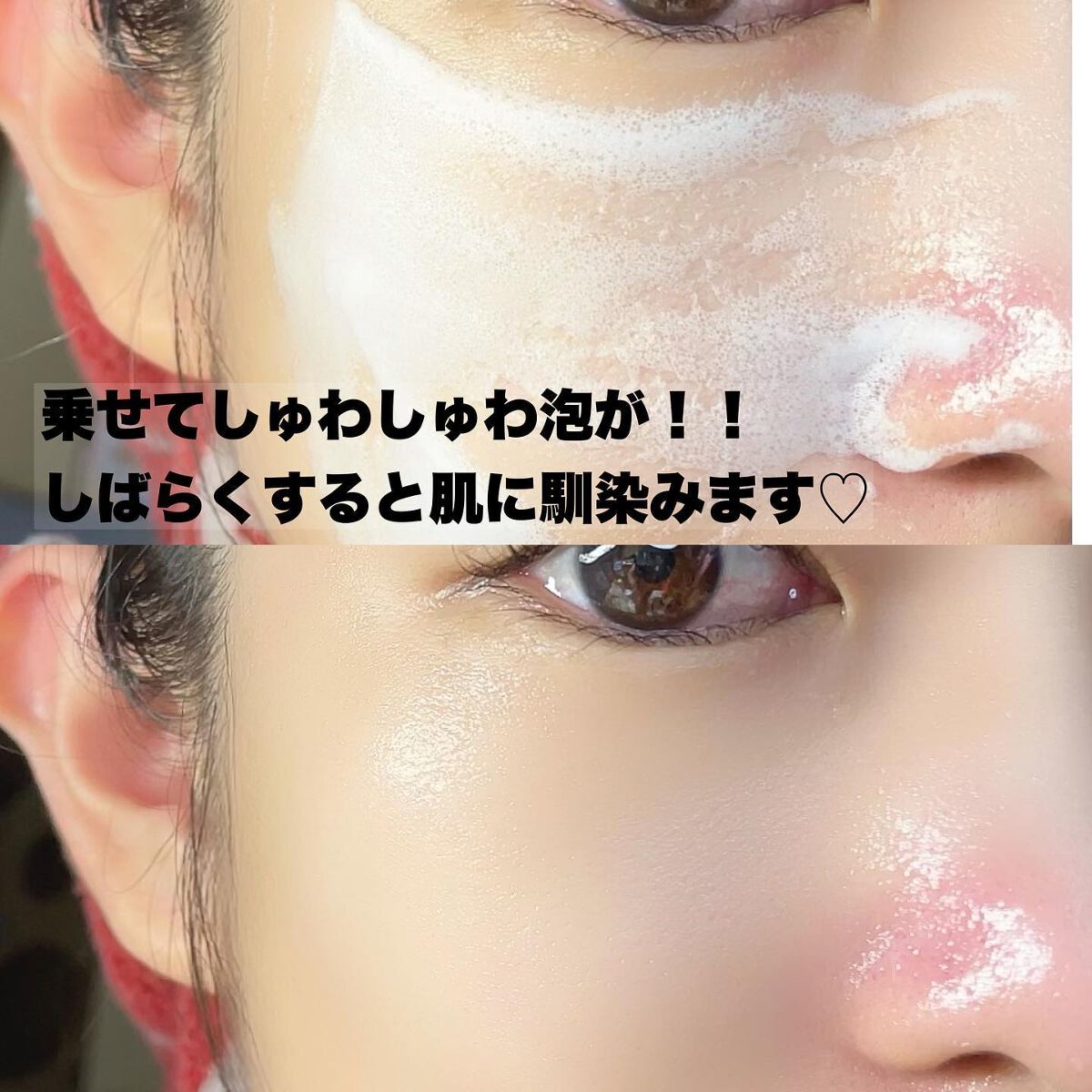 マジックバブルエッセンスパックMINI/BAKER7/シートマスク・パックを使ったクチコミ(4枚目)