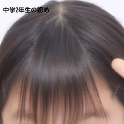 垢抜けたい女の子👧 on LIPS 「これが私の前髪の過去!!みんなこれみて元気出せ!!!!!私の現..」(7枚目)