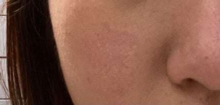 すずめ on LIPS 「1日出掛けてマスクを外したら肌がこのような状態になります💦ファ..」(1枚目)