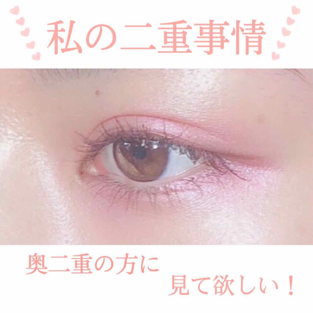 救急ばんそうこう/ドン・キホーテ/その他を使ったクチコミ（1枚目）