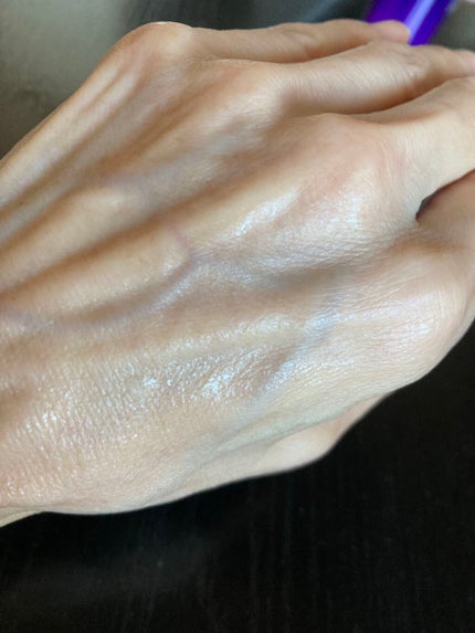 モイスチャーローション/shimaboshi/化粧水を使ったクチコミ(5枚目)