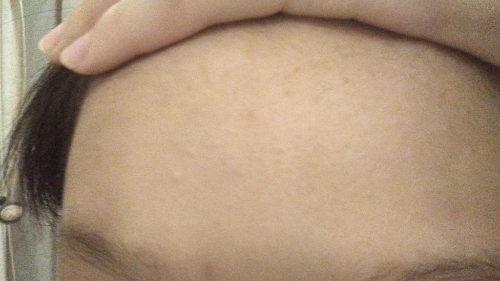 アポスティークリーム(医薬品)/アポスティー/その他を使ったクチコミ(2枚目)