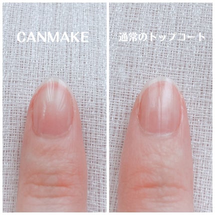 ジェルボリュームトップコート/キャンメイク/ネイルトップコートを使ったクチコミ(7枚目)