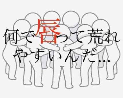 モアリップ N (医薬品)/資生堂薬品/その他を使ったクチコミ(1枚目)