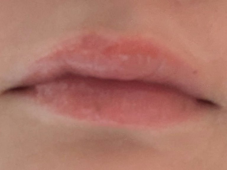 リップボム プランパーセラム/エリザベス/リッププランパーを使ったクチコミ(2枚目)