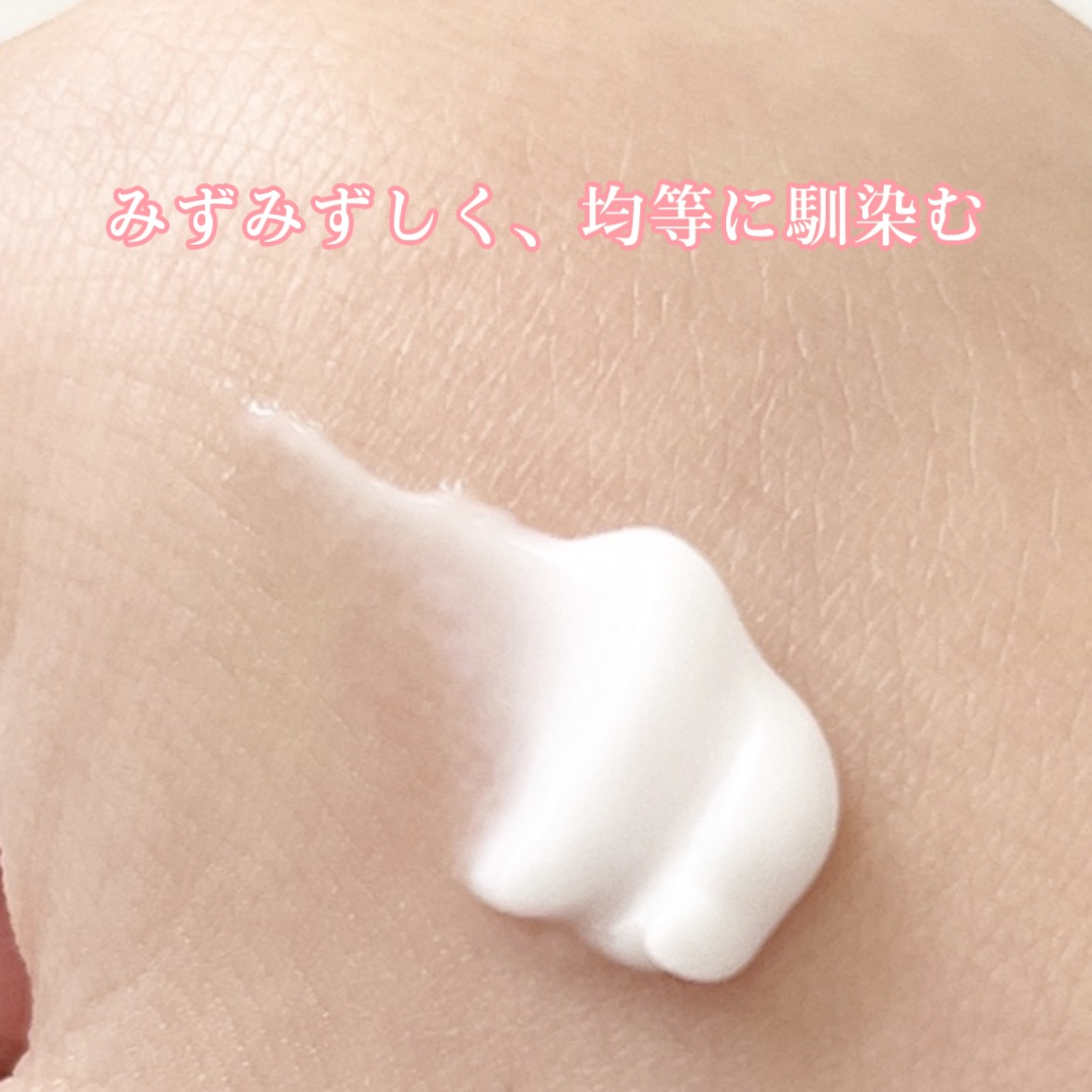 アクネキュアクリーム(医薬品) 16g/IHADA/その他を使ったクチコミ（2枚目）