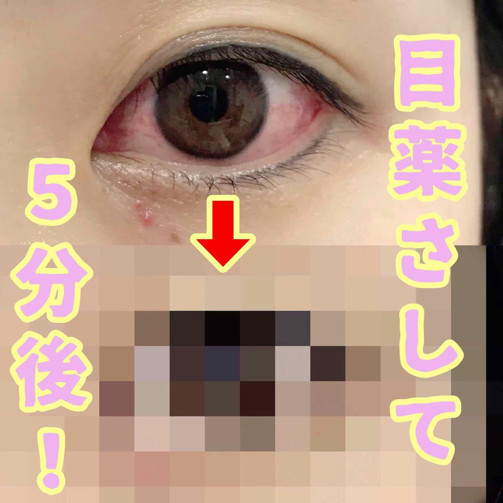 サンテ ボーティエ(医薬品)/参天製薬/その他を使ったクチコミ（1枚目）