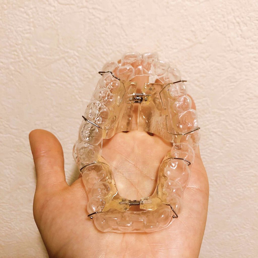 おたむ@フォロバ99 on LIPS 「約1年使ってたマウスピース矯正『キレイライン』についてなるべく..」(5枚目)