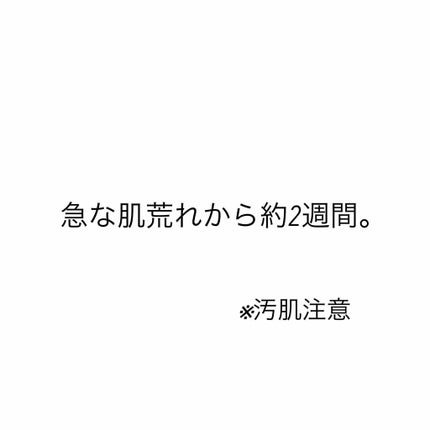 ハトムギ化粧水(ナチュリエ スキンコンディショナー R )/ナチュリエ/化粧水を使ったクチコミ(1枚目)