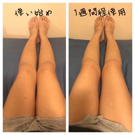 ææ¢šè±ð· on LIPS ããAveeno1%HydrocortisoneANTI-ITC..ãïŒ2æç®ïŒ