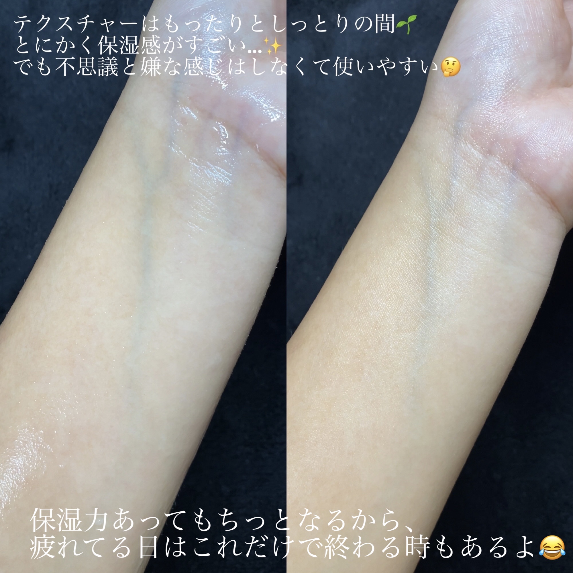 フルフィットプロポリスシナジートナー/COSRX/化粧水を使ったクチコミ（3枚目）