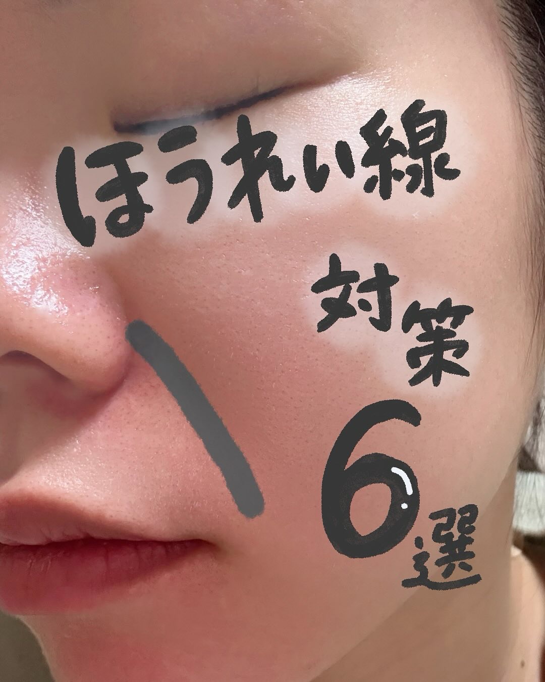 薬用 リンクルセラム/エトヴォス/美容液を使ったクチコミ（1枚目）