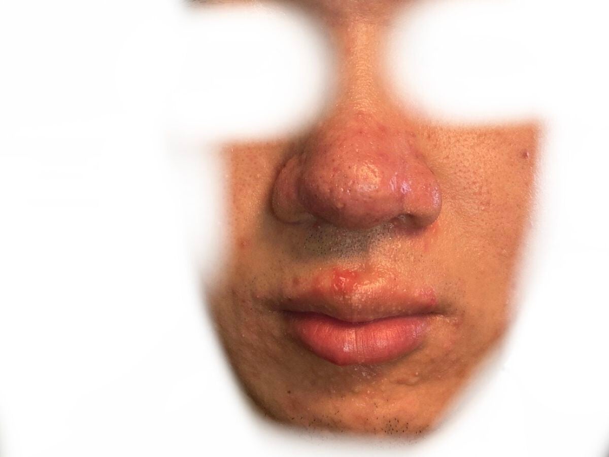 CICA デイリースージングマスク/VT/シートマスク・パックを使ったクチコミ(2枚目)