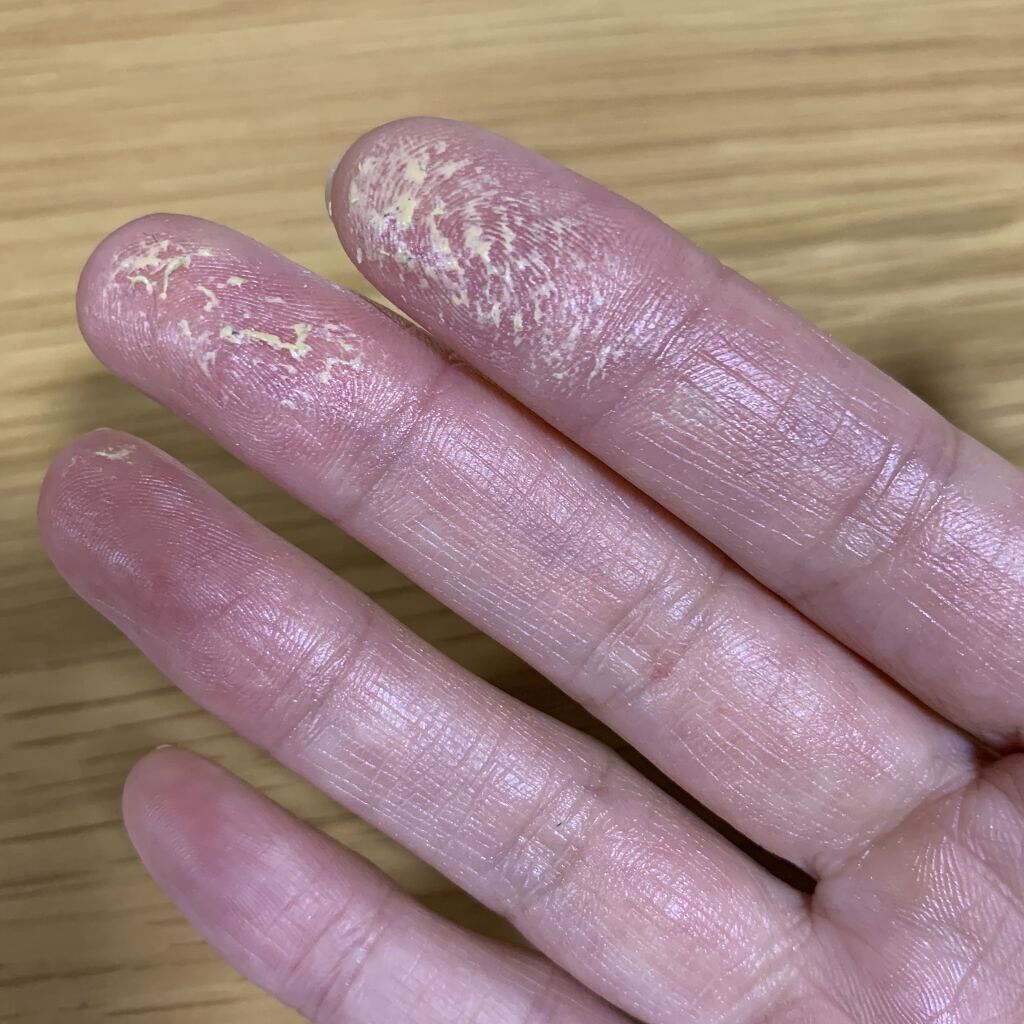 カナデル プレミアバランサー /CANADEL/オールインワン化粧品を使ったクチコミ（2枚目）