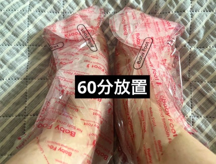 イージーパックDP60分タイプ/ベビーフット/レッグ・フットケアを使ったクチコミ(3枚目)