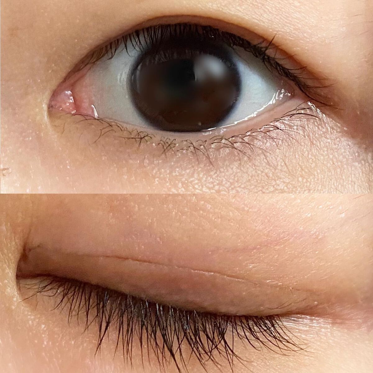 フリーファイバー120<下地&カッター付き>スタンダードタイプ 120本入/メザイク/二重まぶた用アイテムを使ったクチコミ(1枚目)