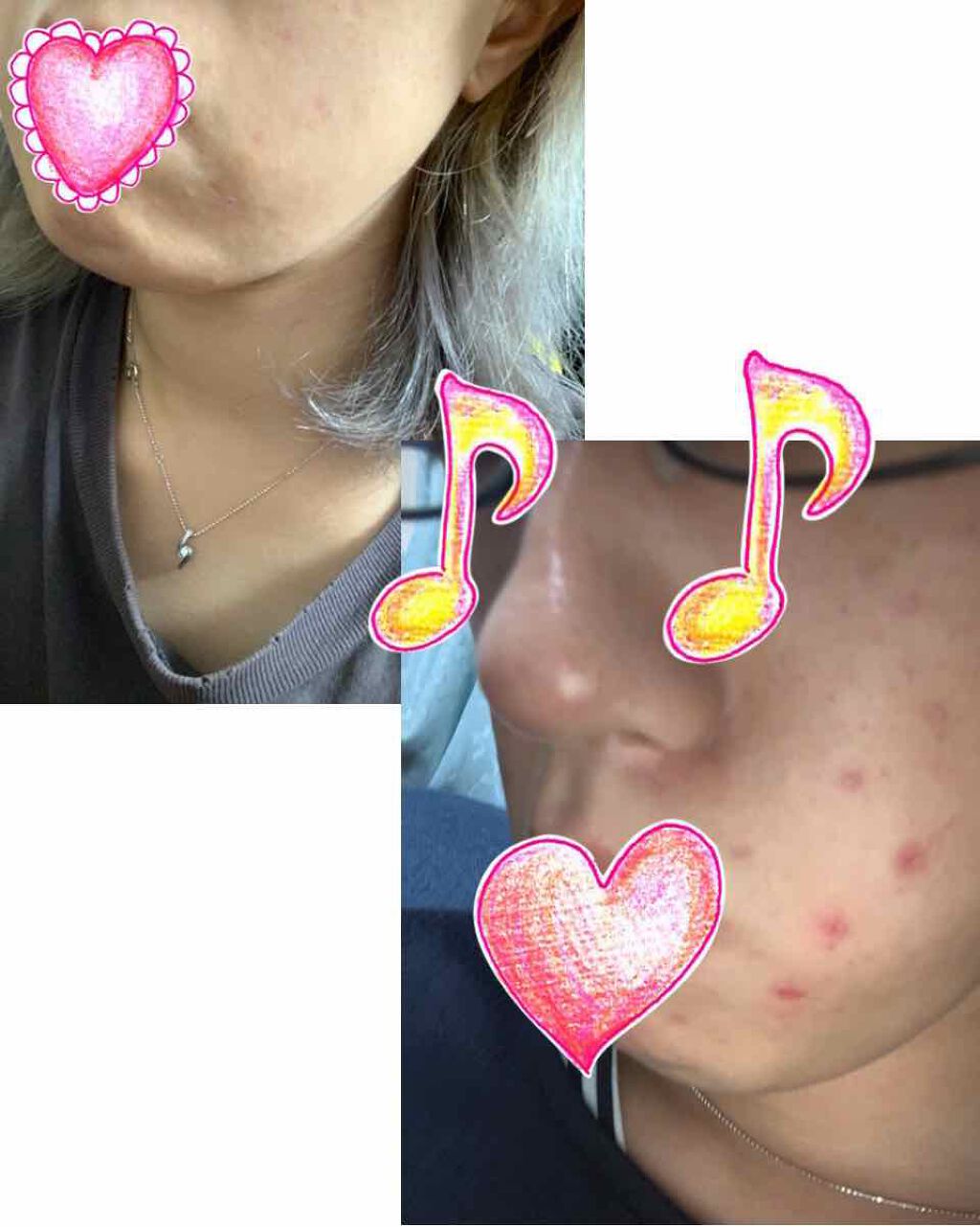 インビジブルピーリングブースターエッセンス/CNP Laboratory/ブースター・導入液を使ったクチコミ(3枚目)