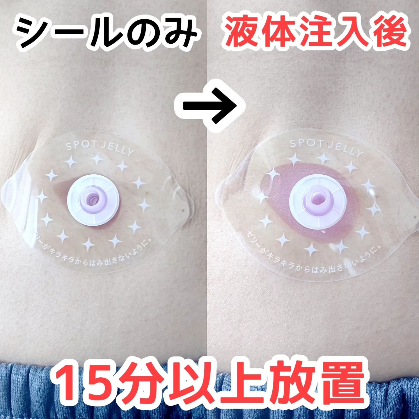 SPOT JELLY（スポッ！とジェリー）へそごまパック｜花王の口コミ
